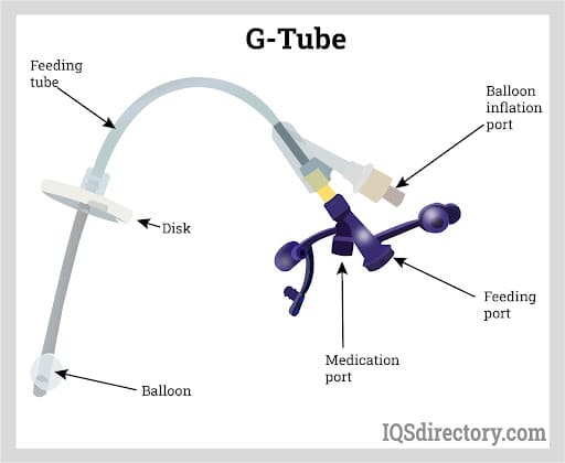 G-Tube